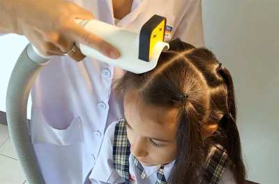 Head Lice Removal Chiang Mai with 30 day guarantee